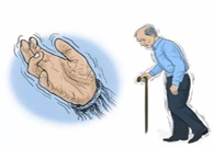 帕金森病，，，，，，，“帕”不怕？？？？？？？？