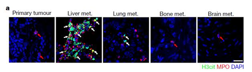 转入小鼠模子获得相同的试验效果，，，，，，且在转移爆发前NET已在肝脏聚积。。。。。