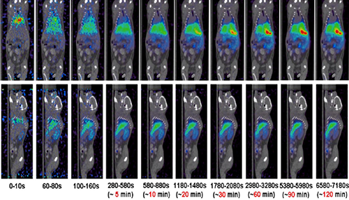 米乐YY易游PET/CT分子影像手艺平台
