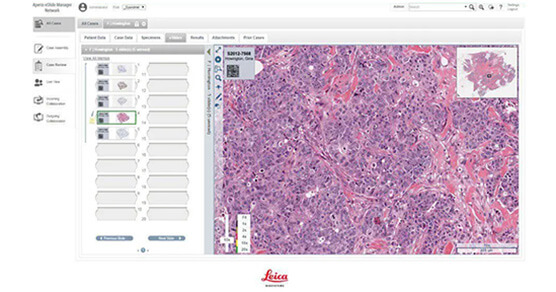 Leica--eSlide剖析管理软件
