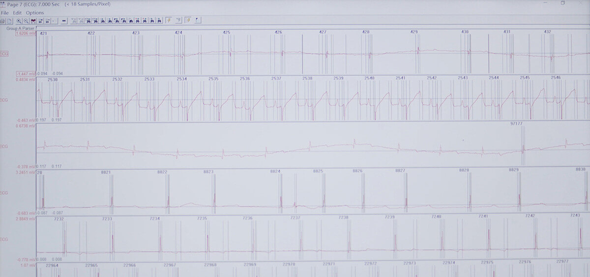 米乐YY易游 SEND 数据转换平台