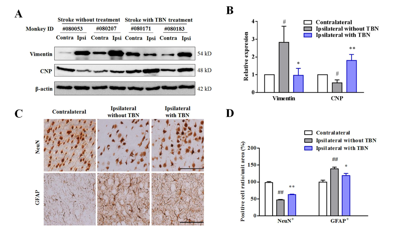 TBN是一种治疗缺血性卒中的新型临床候选药物，，，，，本研究中TBN通过米乐YY易游合成